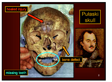 [Pulaski Skull ]